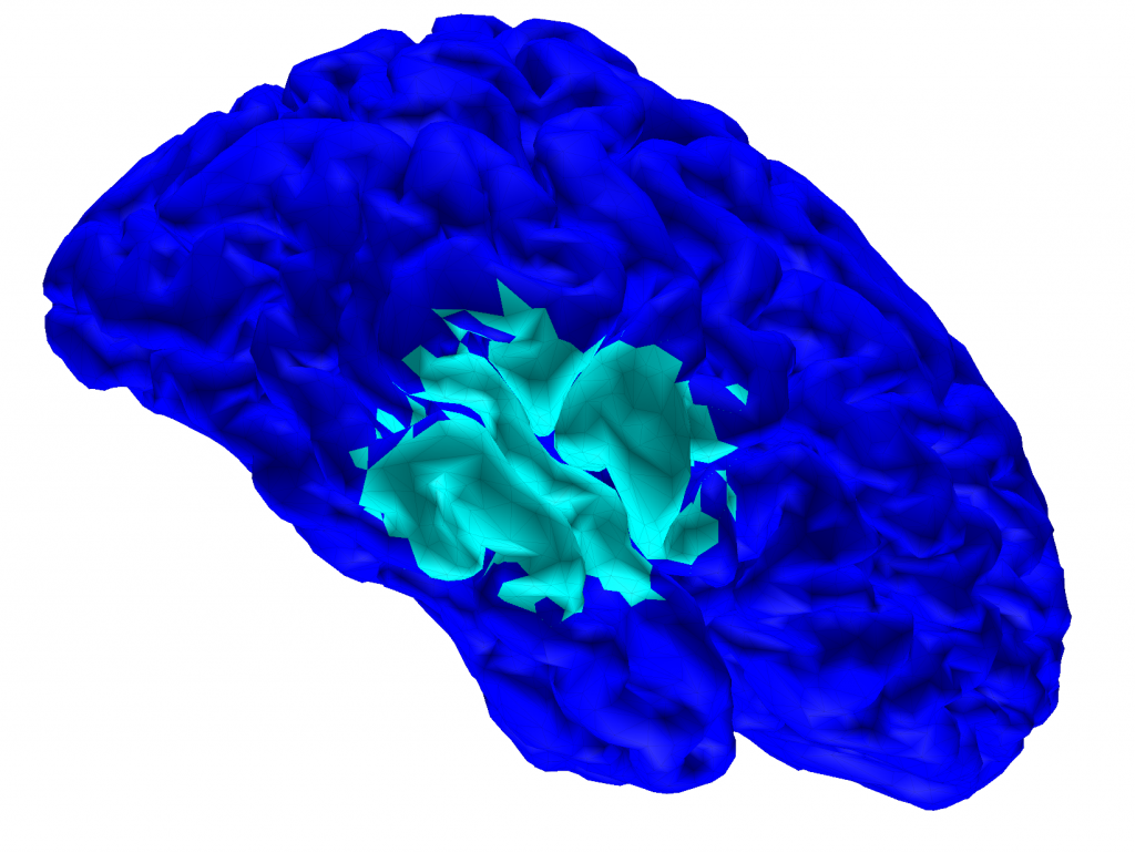 Illustration of a lateral view of the right brain